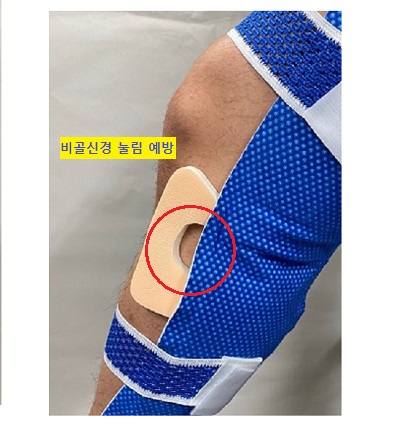 비골폼 착용사진 3.jpg